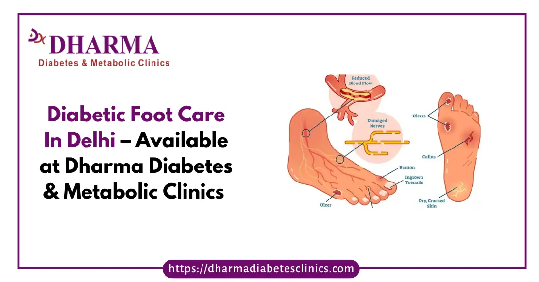Diabetic Foot Care In Delhi