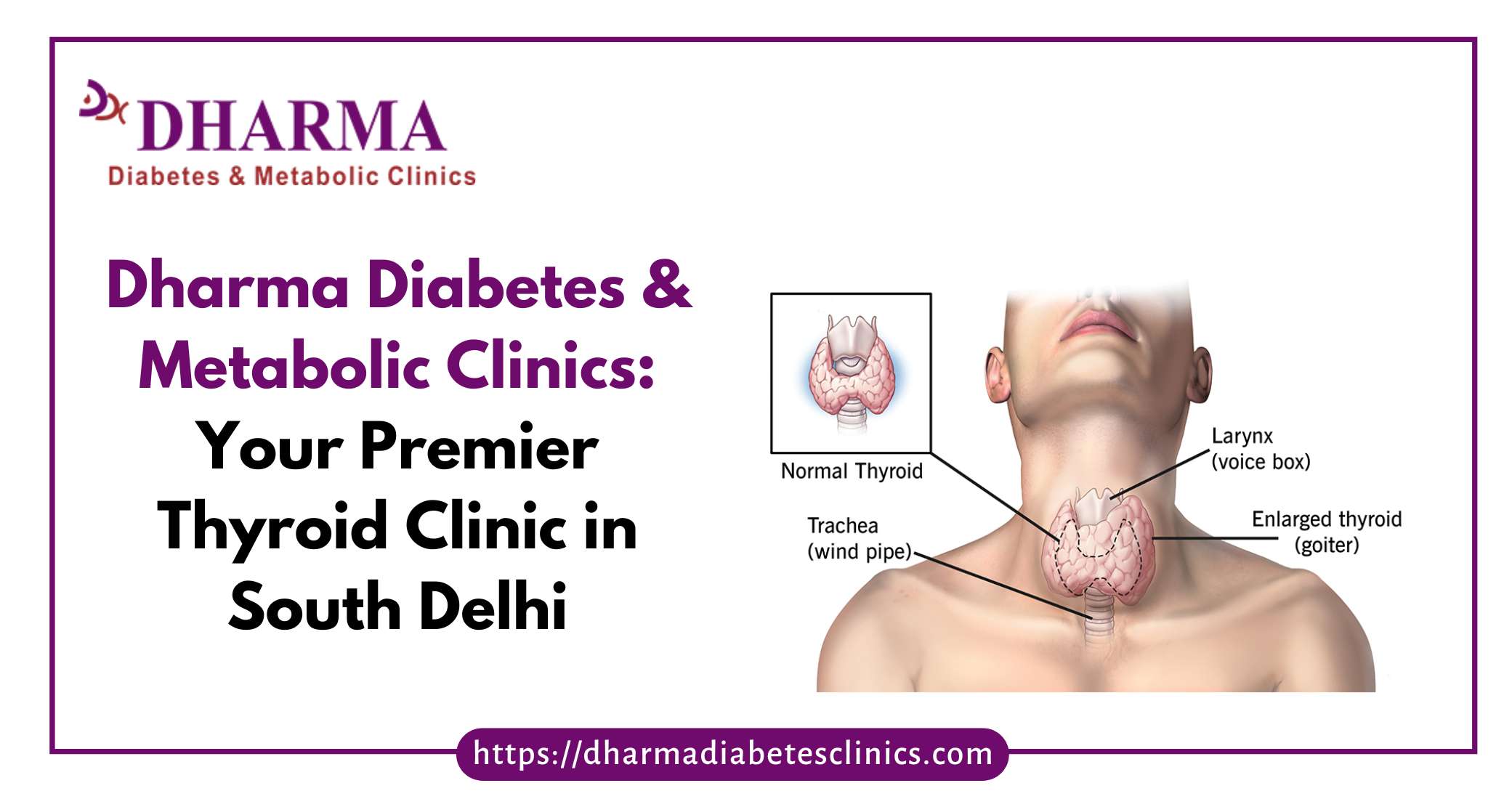 Thyroid Clinic in South Delhi